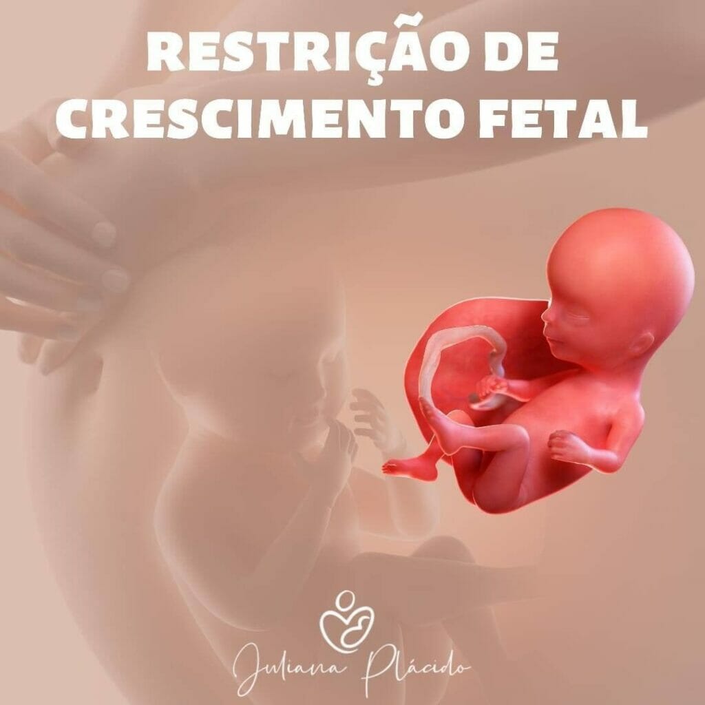 Restrição De Crescimento Fetal Dra Juliana Placido Ultrassom Em Araguaína To 