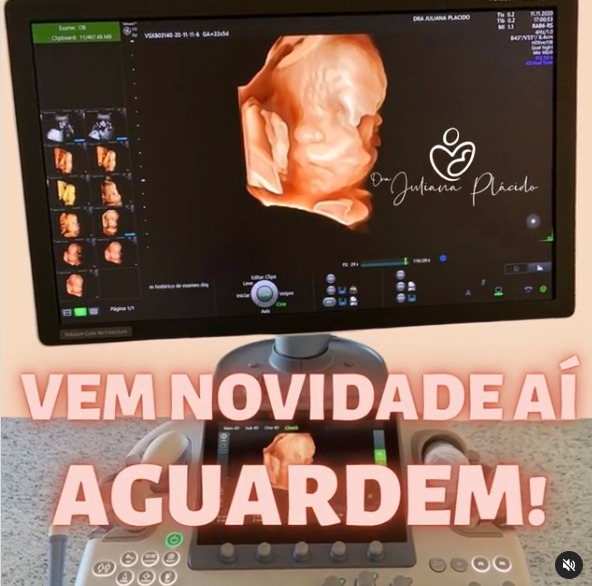 Aguardem Vem Novidade Por Ai Dra Juliana Placido Ultrassom Em Araguaína To 