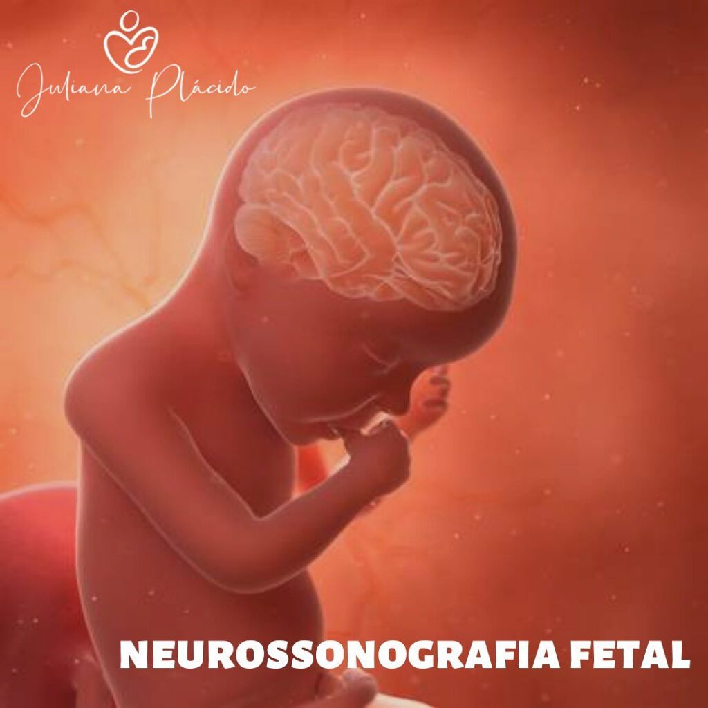 Neurossonografia Fetal Dra Juliana Placido Ultrassom Em Araguaína To 